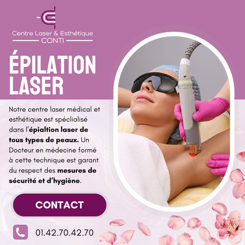 epilation laser 95 epilation laser 95