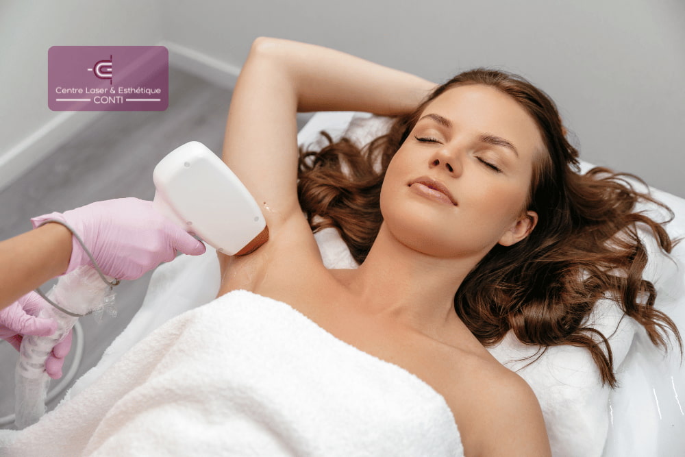 epilation definitive aisselle